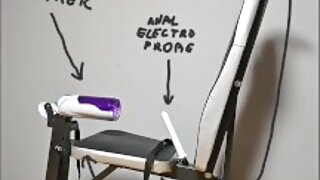 Prostate